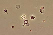 Eumorphic Rbc UroSurf