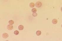 Eumorphic Rbc UroSurf